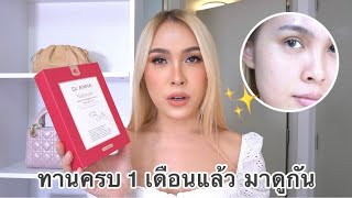 รีวิวผลหลังทานวิตามินลดฝ้าครบ 1 เดือน ฝ้ากระลดลงจริงไหม? | JOSSY BERRY