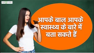 आपके बाल आपके स्वास्थ्य के बारे में बता सकते हैं | WHAT YOUR HAIR TELL ABOUT YOUR HEALTH? | ASKIGURU