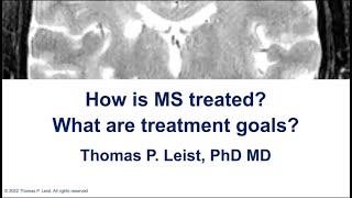 Treatment approaches and goals in MS