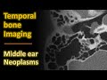 Temporal Bone Imaging - Glomus tympanicum & other middle ear neoplasms