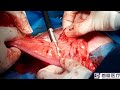 Electro surgical vessel sealer cutting experiment