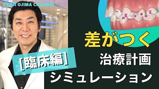 【臨床編】ここで差が出る治療計画シミュレーション