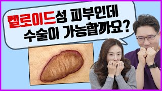 고통받는 켈로이드성 피부, 성형 수술이 가능할까?(feat. 내가 켈로이드 인지 확인하기!)