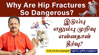 இடுப்பு எலும்பு முறிவுக்கான தீர்வு என்ன ? Why are Hip Fractures so dangerous? Dr. Loganathan M S