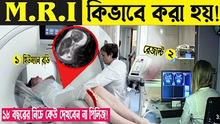 এম আর আই MRI কিভাবে করা হয় দেখলে মাথা ঘুরে যাবে। সকল রোগ নির্নয়ের বাপ MRI scan