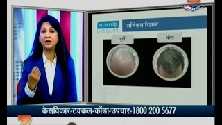 Hello Doctor | Dr Sonal Shah | Of Richfeel On Hair Problem And Baldhead | 27th January 2017