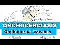 onchocerciasis | River blindness | Life cycle, symptoms and treatment | Bio science