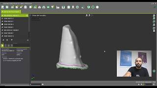 Creación de orden de una corona sencilla mediante uso de scanbody Original Straumann