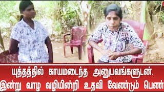 யுத்தத்தில் காயமடைந்த அனுபவங்களுடன் - இன்று வாழ வழியின்றி உதவி வேண்டும் பெண்.