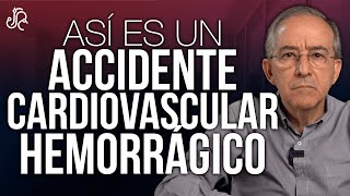 Cómo Es Un Accidente Cerebro Vascular Hemorrágico ? - Oswaldo Restrepo RSC