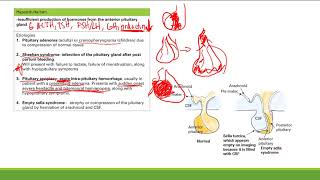 Hypopituitarism | Endocrine System | Step 1 Simplified