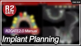 10. R2GATE 2.0 manual_Implant planning (EN)