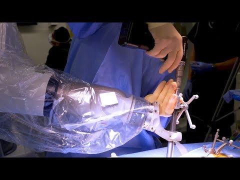 Robotic Spine Surgery Explained Youtube