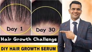 Powerful Hair Growth Serum For Extreme Hair Growth | Regrow Lost Hair Get Double Density in 30 days