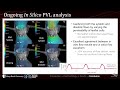 Overview of my Doctoral Research (TAVR simulations, Biomedical Engineering, Stony Brook University)