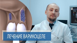 КАК ЛЕЧИТЬ ВАРИКОЦЕЛЕ? | Часть 2