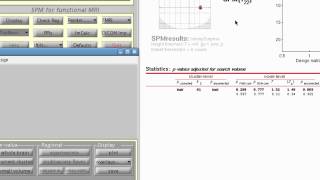 Quick and Efficient ROI Analysis in SPM: Part 1