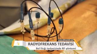 Radyofrekans Yöntemi ile Bel Fıtığı Tedavisi