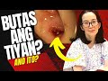 DOCTOR EXPLAINS: KRIS AQUINO, may BAGONG sakit?