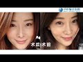 陳俊光醫師領銜 台灣淨妍醫美集團3d小翹鼻