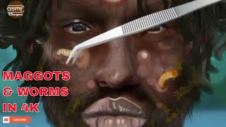 4K ASMR REMOVING WORMS AND MAGGOTS | SOCCER PLAYER GOT INFECTED