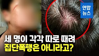 "머리 밟았다"…중학생 형들에 폭행당한 초등생, 경찰 수사 / 연합뉴스 (Yonhapnews)