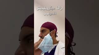 ازالة تاتو الحواجب باستخذام ليزر البيكو