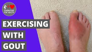 What exercise you SHOULD do with Gout
