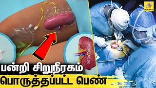 மனித உடலுக்குள் பன்றியின் சிறுநீரகம் வைத்து சாதனை | Pig Kidney Transplantation to Human Body