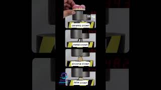 Types of Dental Crowns Tested for Strength | Shahi Dental Clinic Video Demo