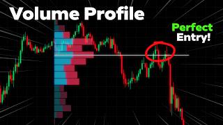 The ONLY Volume Profile Trading Guide You NEED In 2026!
