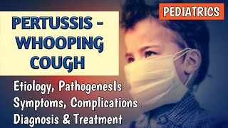 Pertussis Whooping Cough Symptoms, Diagnosis, Treatment, Complications | Pediatrics