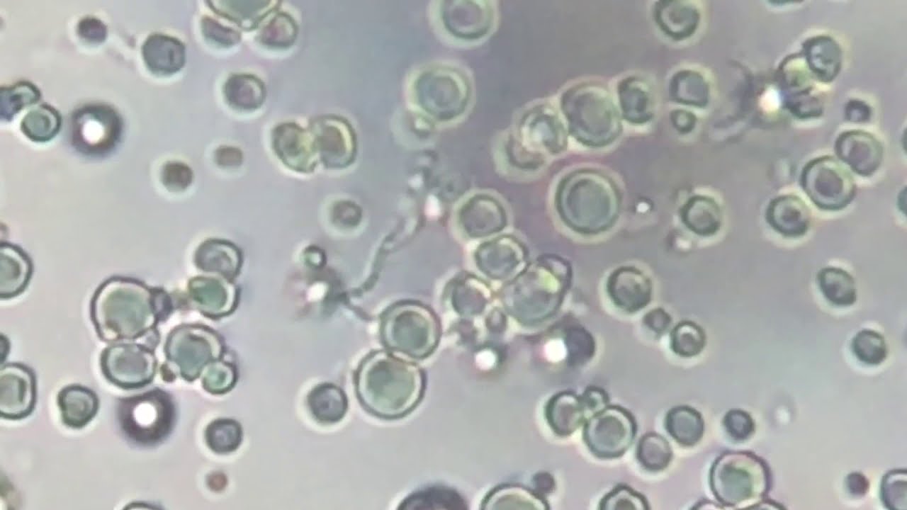 Yogurt Under Microscope At William Fellows Blog