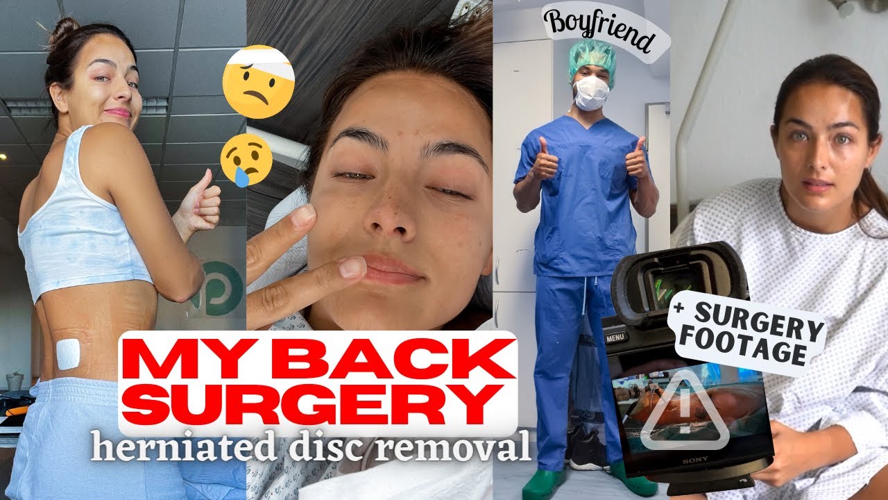 My Surgery Full Experience Vlog Pain Results Help Episode 2