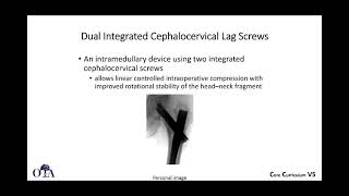 Intertrochanteric femur fractures - 3 of 3