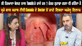 How to Cure Tonsil Problem | Tonsil Infection | Tonsil Infection Causes Canada Doctor | Health Tips