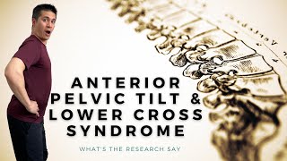 Does Anterior Pelvic Tilt or Lower Cross Syndrome Cause Low Back Pain (Evidence Based Diagnosis)