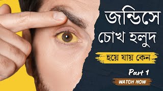 কেন জন্ডিস হলে চোখের রং হলুদ হয়ে যায় || Jaundice @healthtime6469