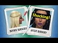 Giving a sim a 1 million dollars plastic surgery | The Sims 4 Ugly to beauty challenge 2020