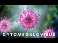 Cytomegalovirus: The Invisible Threat