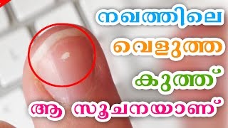 സൂക്ഷിക്കൂ നഖത്തിലെ വെളുത്ത കുത്ത് ആ സൂചനയാണ് | Health Education Tips