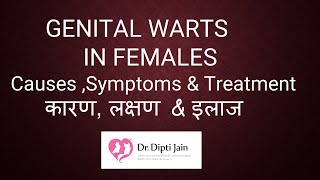 GENITAL WARTS IN FEMALES  - कारण , लक्षण और इलाज  / Causes , Symptoms & Treatment (HINDI)