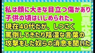 【いじめ 因果応報 スカッとする話】私は顔に大きな目立つ傷があり子供の頃はいじめられた。現在40代だが、しつこく罵倒してきたり陰湿な言葉の攻撃をした奴らの消息を聞いた。