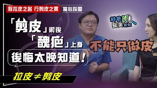 這不是拉皮手術！　「剪皮」術後「醜疤」上身　才發現「踩雷」了！　拉皮、剪皮超難辨  拉皮大師一次說分明 打破醫美謬思155-20200605