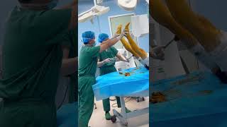 惊人的画面，这是什么手术 #doctor #hospital #shortvideo