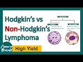 Hodgkin vs Non Hodgkin Lymphoma | Differences between Hodgkin and Non Hodgkin lymphoma