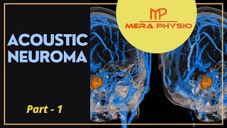 Brain Tumour (Acoustic Neuroma) - part 1 | Introduction | In Hindi | Mera Physio