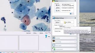 PAXcamX Microscope Camera - Basic Controls for Pathology Samples