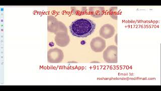 Python Code for Blood Cell Type Detection Using Neural Network CNN | Final Year Project Source Code