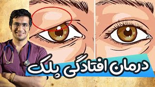 Droopy Eyelid Causes and Treatment | درمان افتادگی پلک